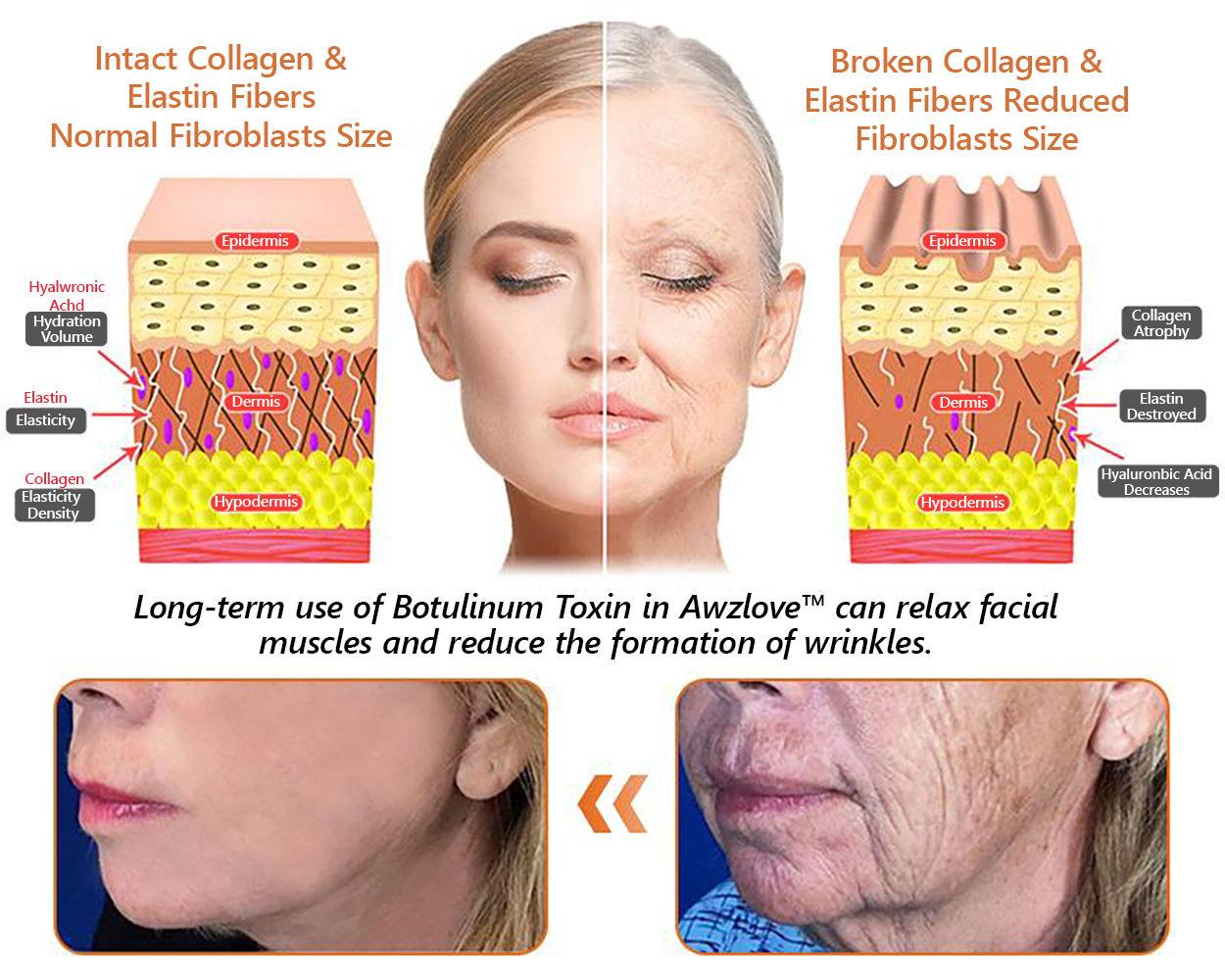 Sainishops™AH 8 Bee Venom Firming Total Lift Body Cream Clinically Tested by Dermatologists