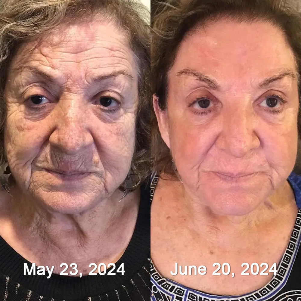 Sainishops™AH 8 Bee Venom Firming Total Lift Body Cream Clinically Tested by Dermatologists